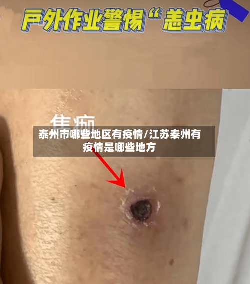 泰州市哪些地区有疫情/江苏泰州有疫情是哪些地方-第1张图片